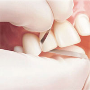 Compo Strips 6/pk- Premier - Dental Supplies