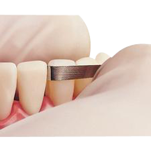 Compo Strips 6/pk- Premier - Dental Supplies