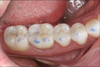 Bausch Articulating Paper - Dental Supplies