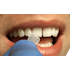 ProVeneer-In Office Veneer System-Silmet-Dental Supplies	