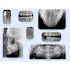 MARK3 Intaoral Phosphor Imagaing Plates - dental supplies