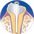 Cure-Thru® IntegraPost®  - Zirconia Glass Fiber Posts 10/pk - Premier Dental