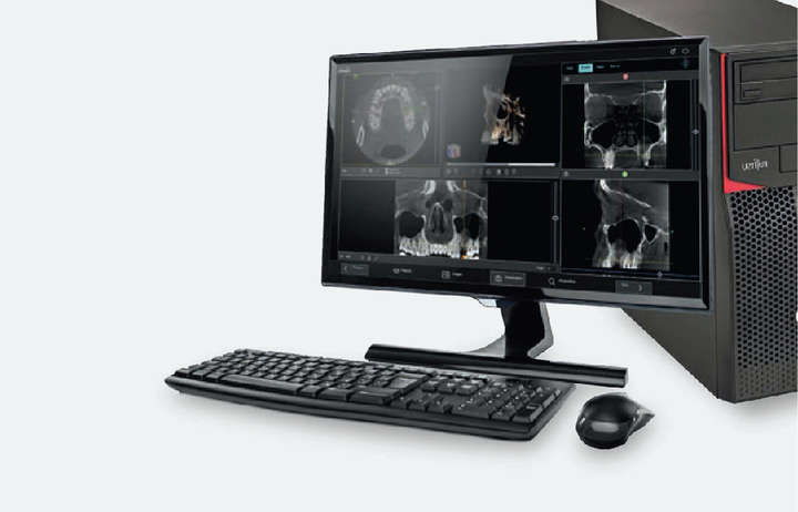 Duray 2D Ceph Extraoral X-Ray Series - Beyes Dental